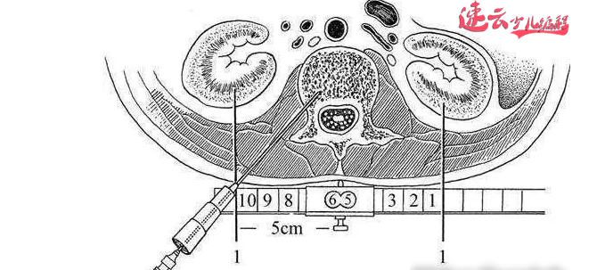 济南少儿编程：17岁女孩用人工智能，编写出了预测癌症的程序！~山东少儿编程~少儿编程(图9)
